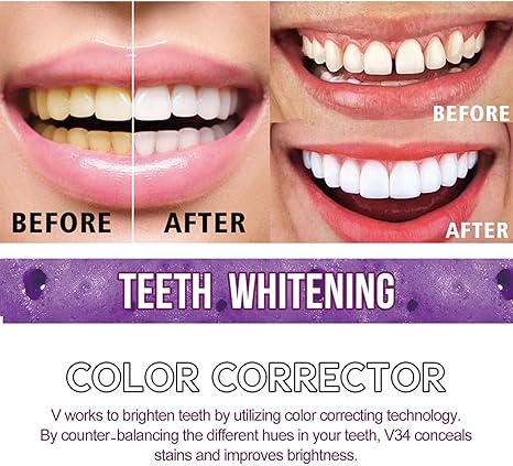 Toothpaste for sensitive teeth and whitening - Luxoras