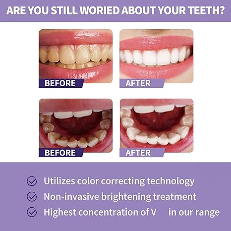 Toothpaste for sensitive teeth and whitening - Luxoras
